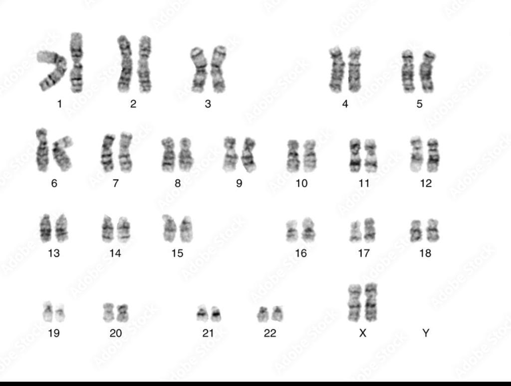 Как определить хромосомную болезнь?